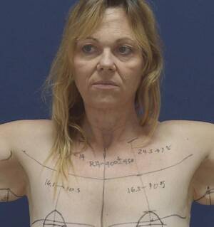 Adult Sex On Nude Beach - Review: TV One's Beauty and the Beach is plastic surgery porn - NZ Herald