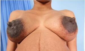big black bumpy nipples - Big Bumpy Black Areolas