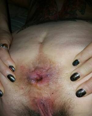 anal whore asshole - Older anal slut big puckered gaping filthy asshole Porn Pictures, XXX  Photos, Sex Images #3843601 - PICTOA