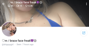 fat teen with braces facial - 15 Best Braces OnlyFans Creators to Follow 2024
