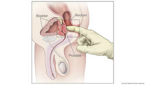 constipation anal sex - offshore conclude result Horny Amateur Milf Porn are the