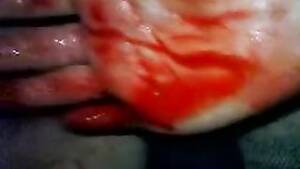 Bleeding Fisting Porn - Fisting a bloody pussy hard