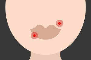 Herpes Porn Doctor - Stoya On Herpes & Money Shots