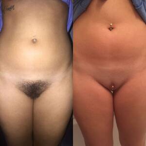 Hairy Pussy Before And After - Shaved Pussy Before And After