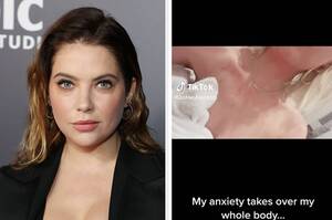 Ashley Benson Sex - Ashley Benson Says Anxiety Gave Her A Rash