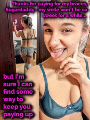 Braces Porn Captions - Femdom Braces Captions | BDSM Fetish