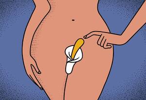 Lesbian Forced Orgasm Tumblr - Clitoral Enlargement Surgery Is Growing