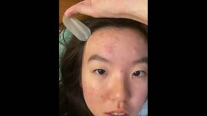Acne Porn Redhead - Acne, Sores, and other Skin Problems | MOTHERLESS.COM â„¢