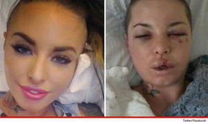 Christy Mack Before Porn - Porn Star Christy Mack -- Free Facial Reconstruction. EXCLUSIVE. Christy ...