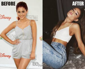 Ariana Grande Big Tits Porn - Ariana Grande Plastic Surgery REVEALED! Then And Now