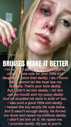 Freckled Porn Captions - Freckled Porn Captions | Sex Pictures Pass