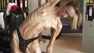 anorexic milk skin - Anorexic Milk Skin | Sex Pictures Pass