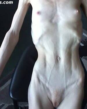 anorexic cindy - anorexic girl Cindy posing naked indoors Porn Pictures, XXX Photos, Sex  Images #2693842 - PICTOA