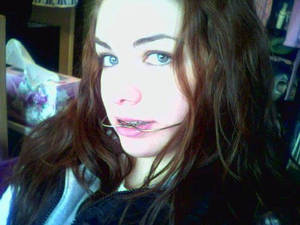 Braces Headgear Porn - Pretika sonicdermbrasion facial brush Â· Softcore couples free galleries. Braces  Headgear Adult Porn ...