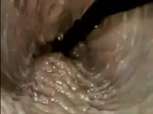 inside view of anal sex - Incredible internal anal view as boyfriend slides his large dick in-and-out  of his lovers asshole - LuxureTV