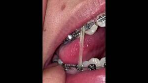 Dental Fetish Porn - Dentist Fetish Porn Videos | Pornhub.com