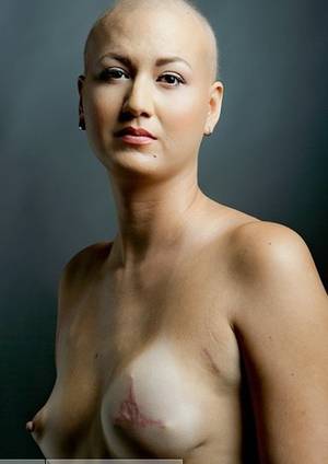 Non Porn Pic Of Genitals - Facebook finally agreed to change its policies so that pictures of breast  cancer survivors and images