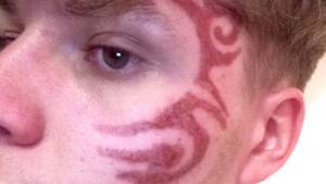 Henna Tattoo Porn - Some British tourists are being left with permanent scars after getting henna  tattoos on holiday.