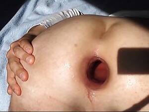 gaping butt holes - Nurse Gapes Unshaven Hole Free Sex Videos - Watch Beautiful and Exciting  Nurse Gapes Unshaven Hole Porn at anybunny.com