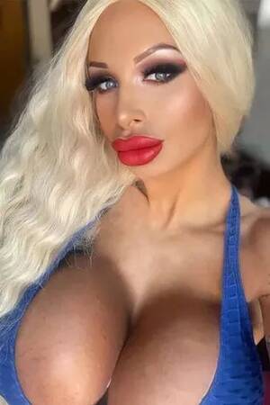 Big Implants Porn - Mum fighting for life with sepsis after 32JJ breast implant explodes in  shower - Mirror Online