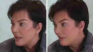 Kris Jenner Shay Fox Porn - Kris Jenner's Facial Transformation Sparks Frenzy