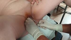 ebony big pussy lips torture - Pussy torture: Labia stitches - ThisVid.com