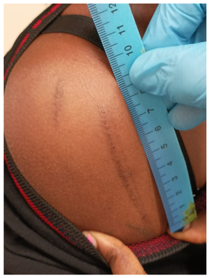 Big Tits In Bondage Forced Orgasm Videos - Healthcare | Free Full-Text | Torture and Maltreatment in Prison: A  Medico-Legal Perspective