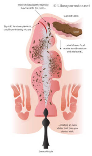 how to do anal - How To Prepare For Anal Sex - Like A Pornstar