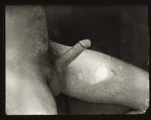erotic penis photography - Unknown photographer, Indiana, United States 'Erect penis' 19th century