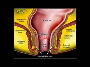 anotomical transexual anal illustration - 