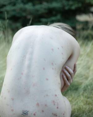 Leann Rimes Naked Porn - LeAnn Rimes Shares 'Honest' Photos of Her Psoriasis