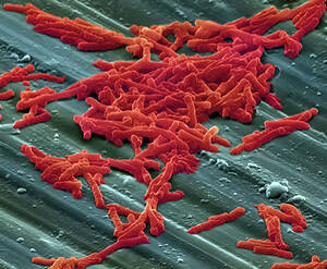 Madison Pettis Pussy Porn - Ð‘ÐµÐ·Ð»Ð¾Ñ‚Ð¾ÐºÑÑƒÐ¼Ð°Ð± ÑÐ½Ð¸Ð¶Ð°ÐµÑ‚ Ð²ÐµÑ€Ð¾ÑÑ‚Ð½Ð¾ÑÑ‚ÑŒ Ñ€ÐµÑ†Ð¸Ð´Ð¸Ð²Ð° Ð¸Ð½Ñ„ÐµÐºÑ†Ð¸Ð¸ C. difficile Ñƒ  Ñ€ÐµÑ†Ð¸Ð¿Ð¸ÐµÐ½Ñ‚Ð¾Ð² Ñ‚Ñ€Ð°Ð½ÑÐ¿Ð»Ð°Ð½Ñ‚Ð°Ñ‚Ð¾Ð² | ÐÐ¾Ð²Ð¾ÑÑ‚Ð¸