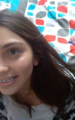 Bracket Porn - âž¤ Descargar Pack Porno de Jessica Morrita Golosa con Brackets Mamando Verga  - Video Gratis (2023)