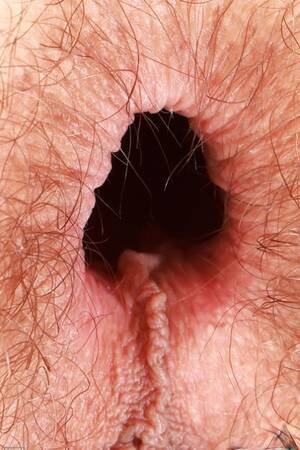 close up asshole - Asshole Close Up Porn Pics - PornPics.com